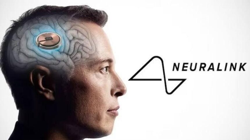 Neuralink pronta a "pimpare" il cervello umano: microchip e progressi a go-go!